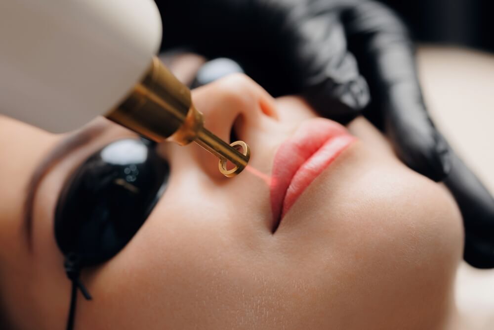 cách trị thâm môi khử thâm môi bằng laser cô gái đeo kính bảo hộ mắt màu đen đang thực hiện liệu trình laser