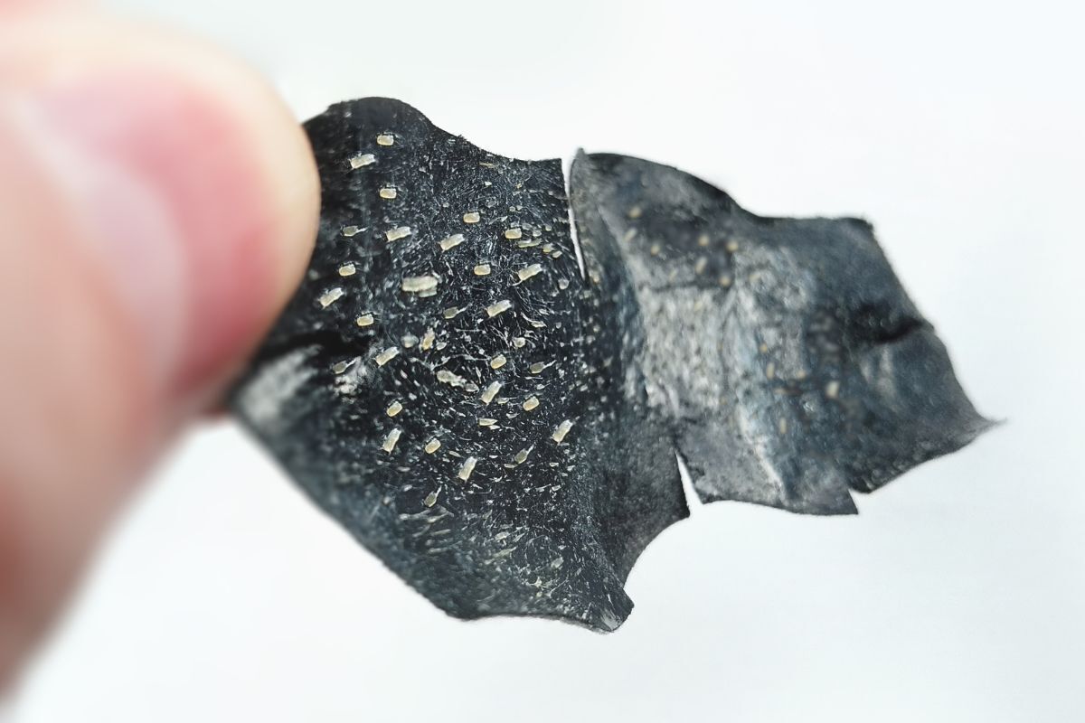 trị mụn đầu đen ở mũi