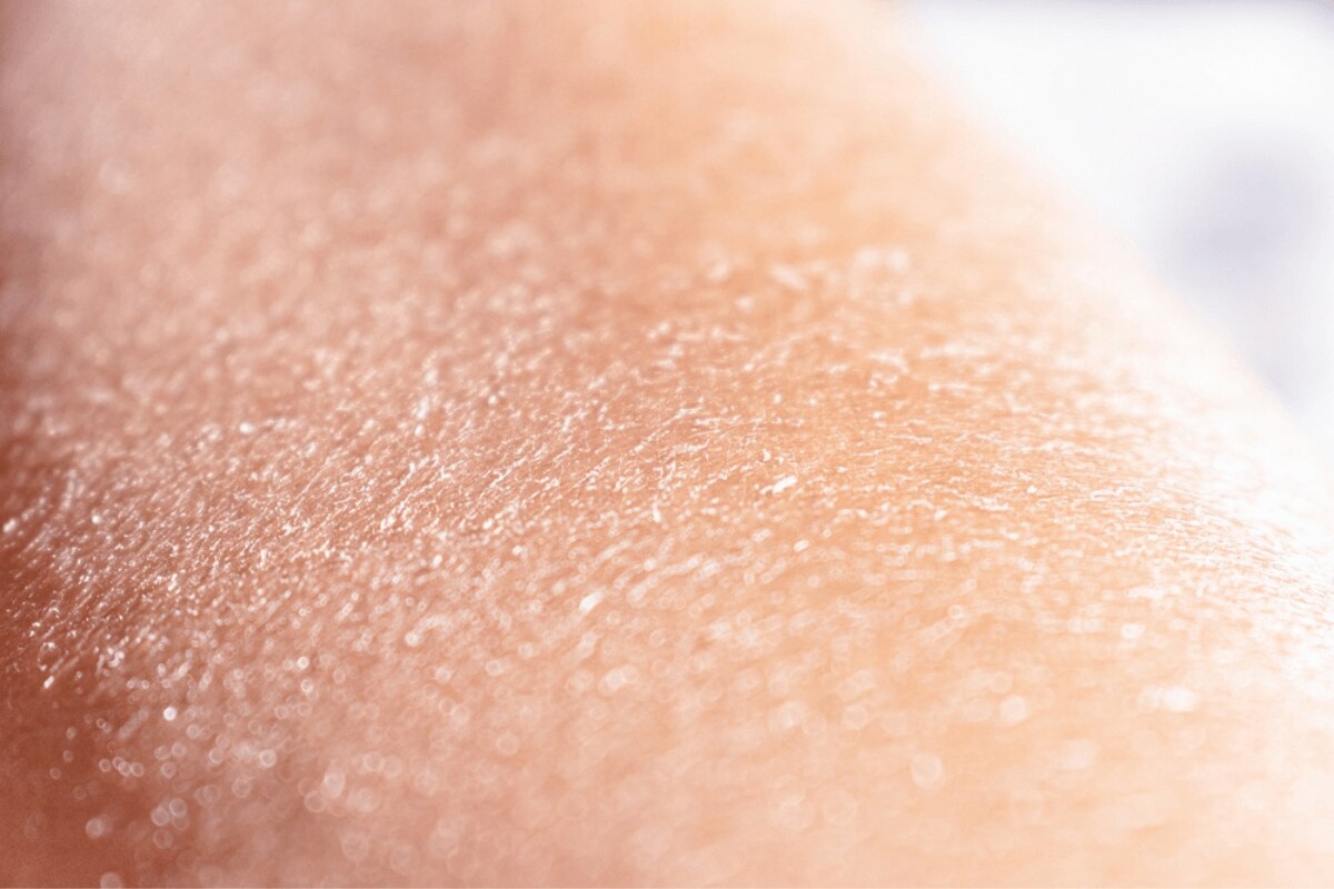 da bị kích ứng nguyên nhân khiến da bị kích ứng tình trạng da