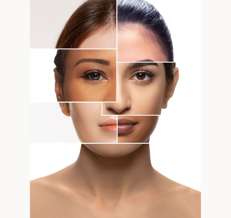 phân biệt các loại mụn cách ngăn ngừa và điều trị mụn xác định đúng loại da.