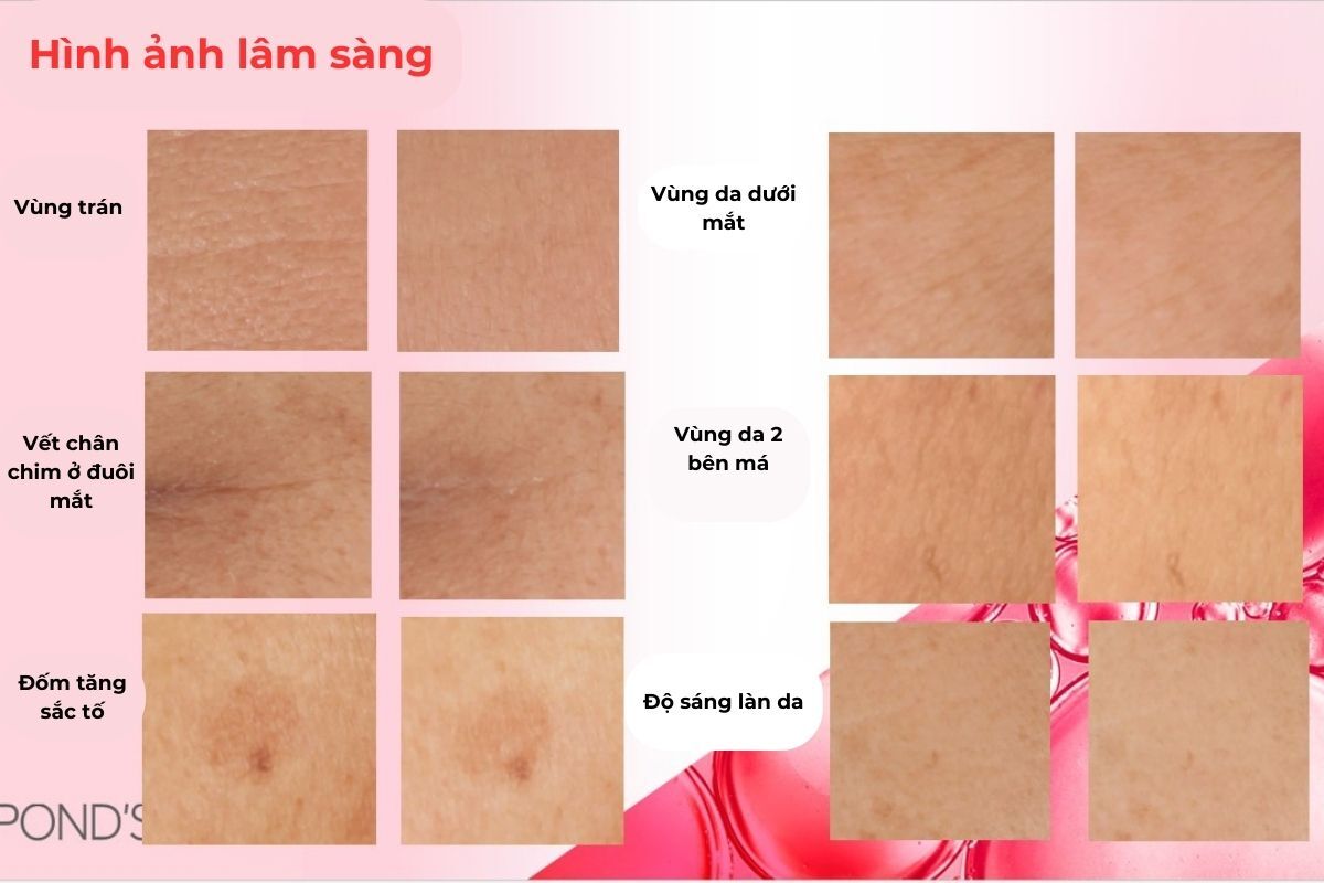 hexyl retinol là gì và hexyl retinol có lợi ích gì đối với làn da