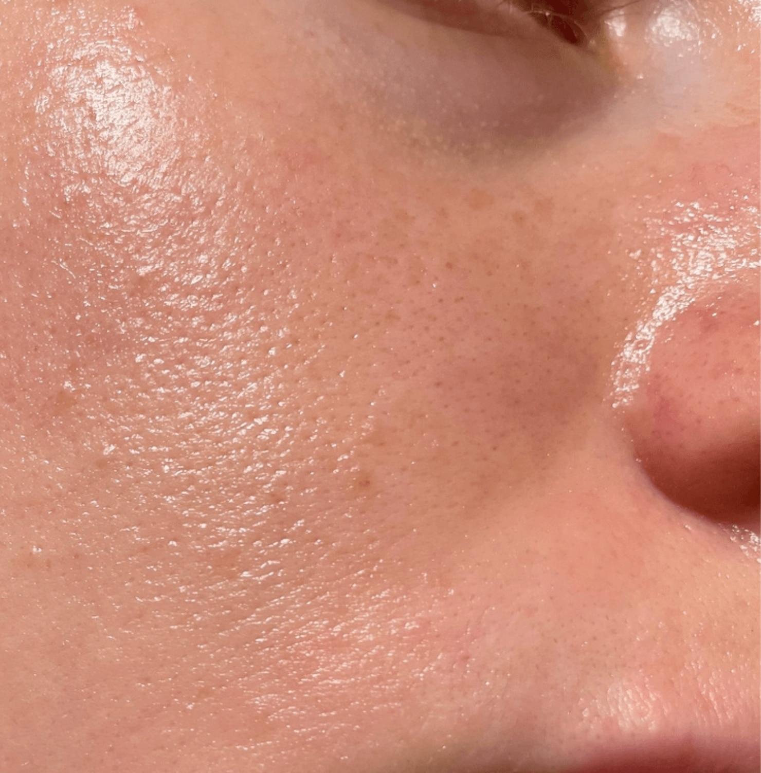 da dầu là gì cách nhận biết da dầu cận cảnh làn da bóng nhờn lỗ chân lông to