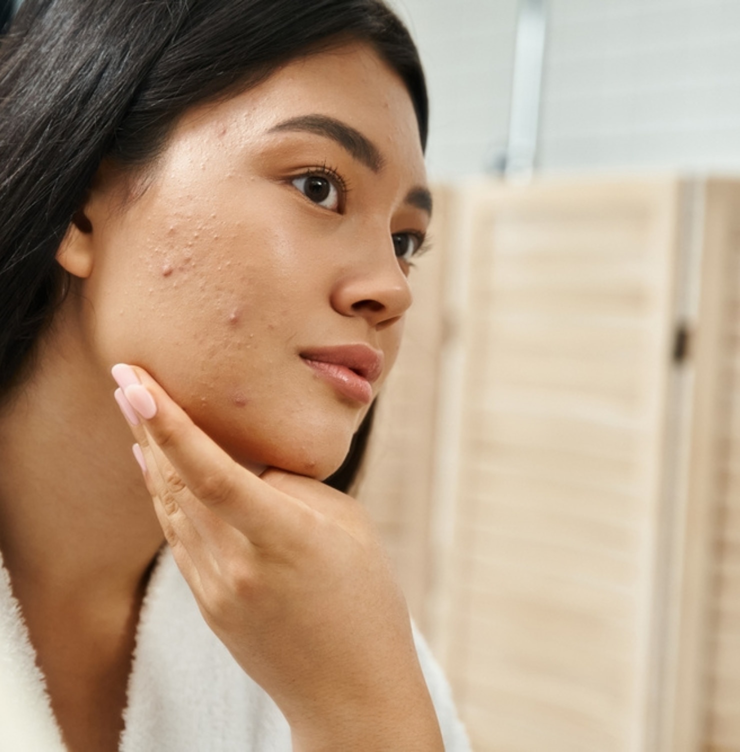 chăm sóc da mụn cô gái cười tươi, đang soi gương và chạm hai tay vào má