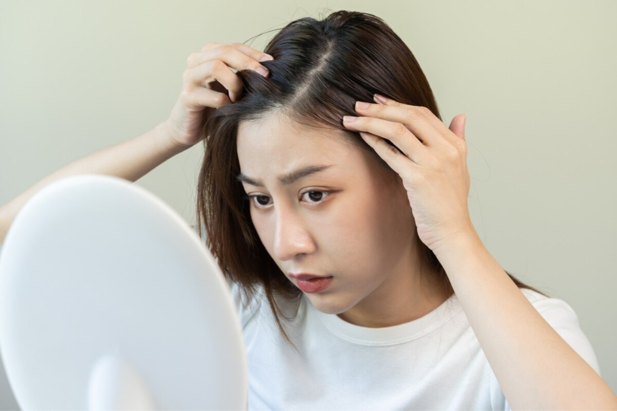 cách trị gàu mảng cô gái nhìn vào da đầu bong tróc, có gàu mảng qua tấm gương tròn.