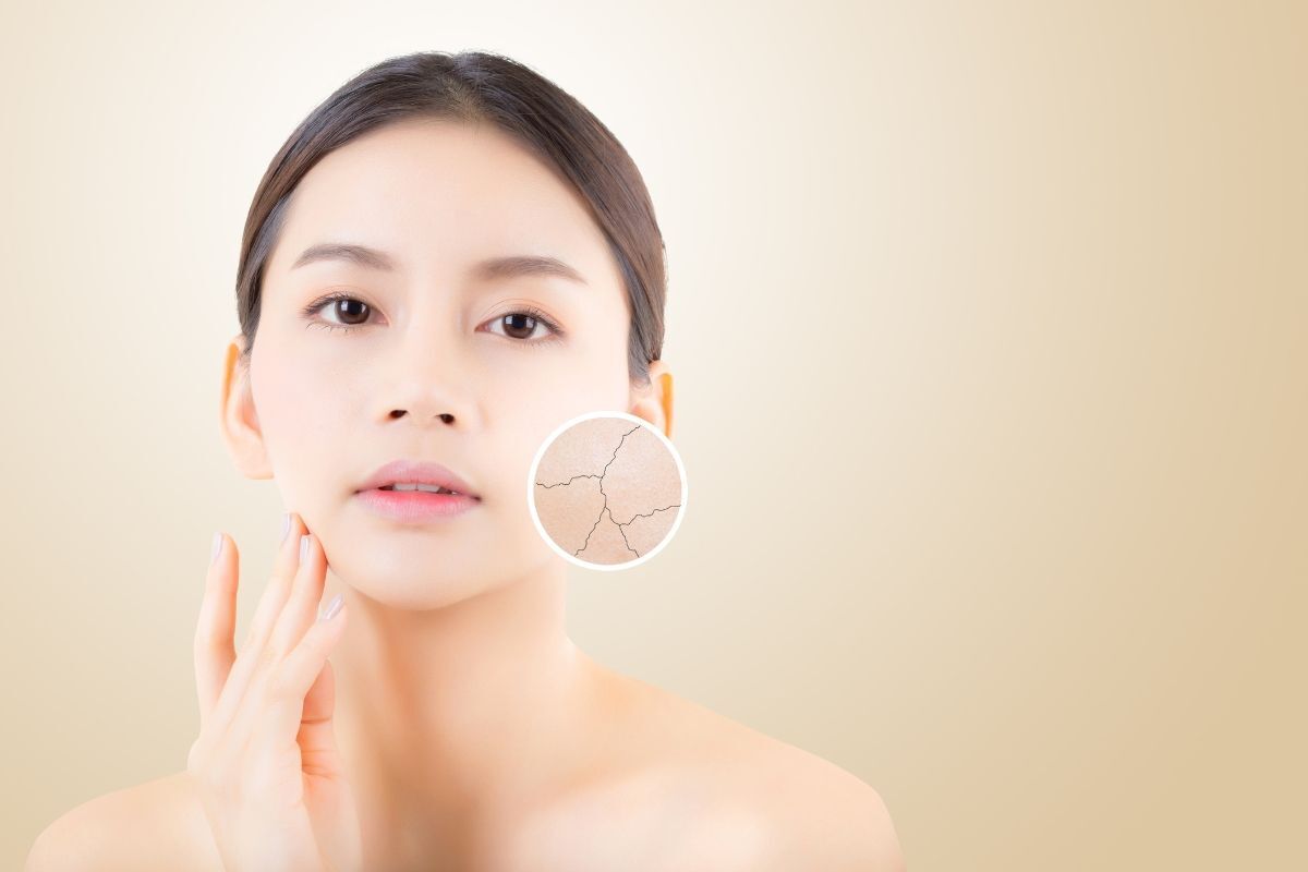 Toner pad cách chọn toner pad phù hợp với loại da cô gái có làn da khô 