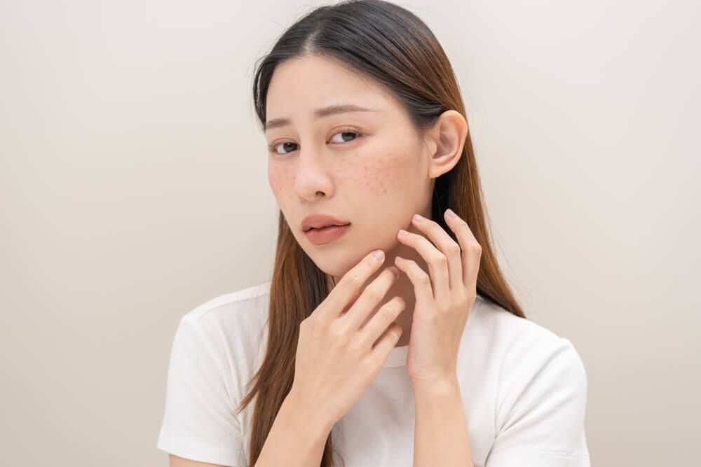 dược mỹ phẩm cách chọn dược mỹ phẩm dưỡng sáng da cô gái đang lo lắng vì những đốm nâu, tàn nhang trên da mặt