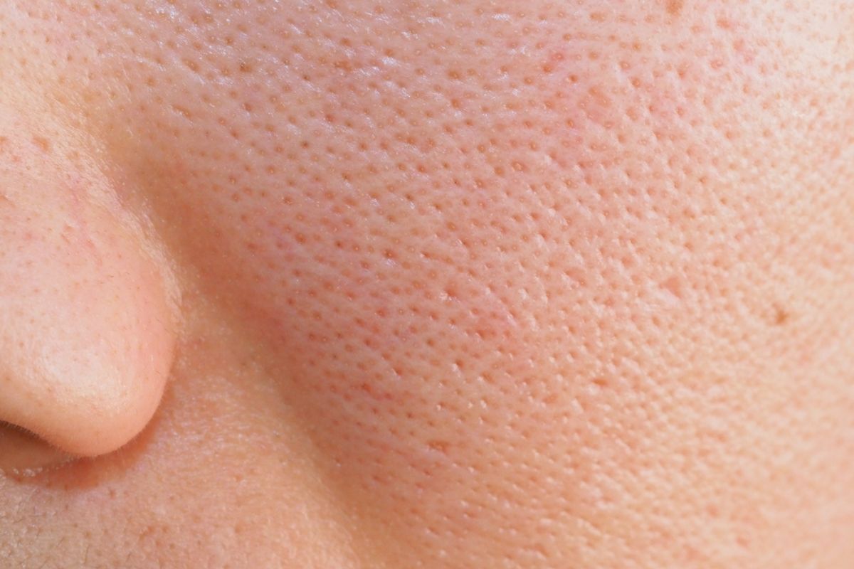 thu nhỏ lỗ chân lông nguyên nhân khiến lỗ chân lông toảnh chụp cận lỗ chân lông to trên da mặt nhờn