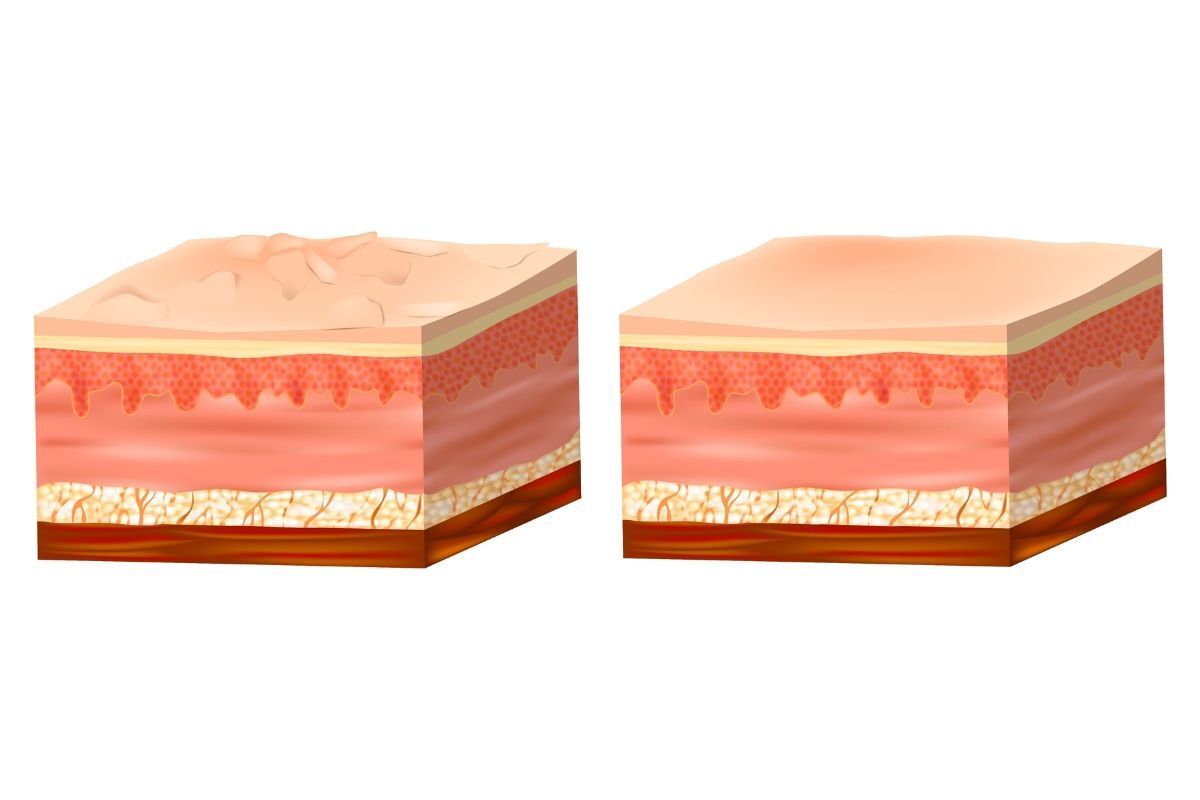 peel da là gì peel da mang lại lợi ích gì