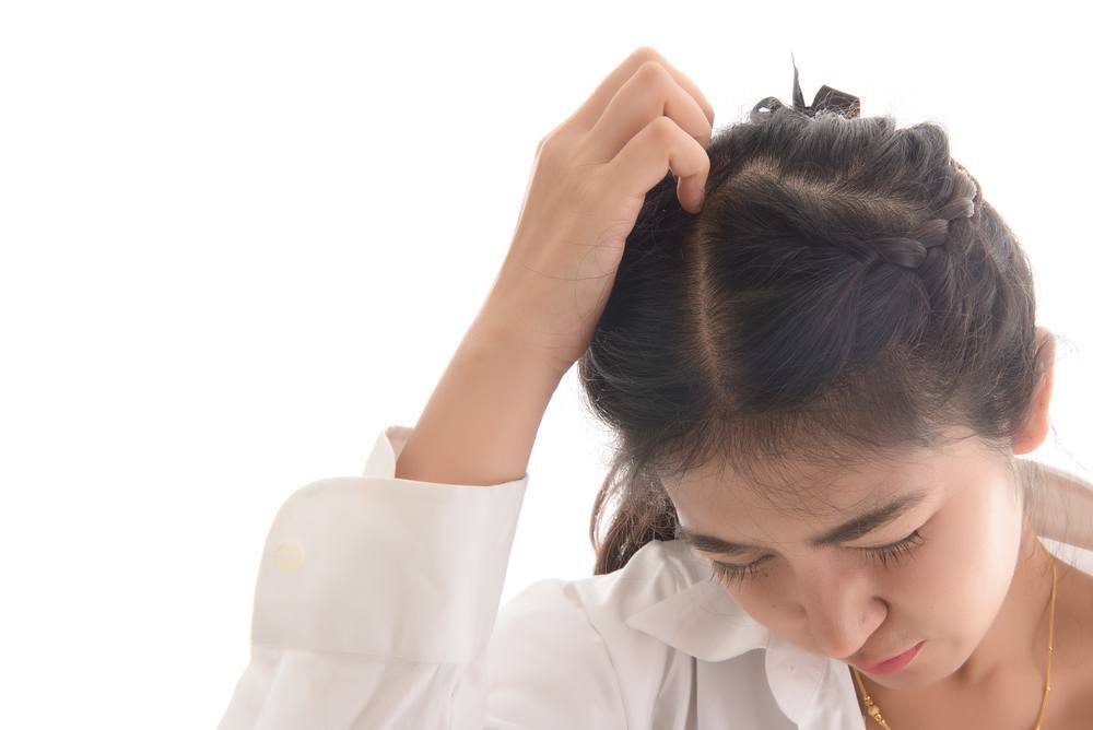 Cara menghilangkan ketombe basah