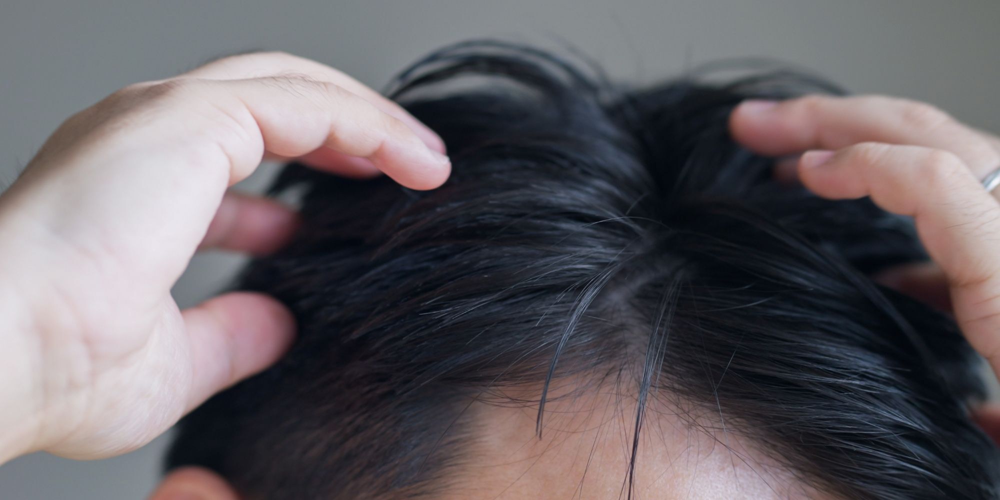 pria dengan rambut yang kering karena butuh vitamin