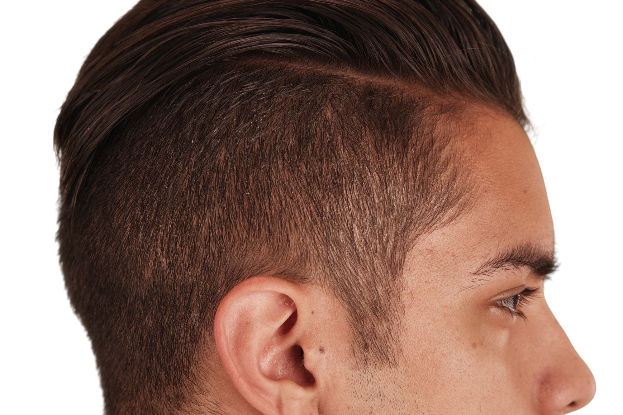 Bagian tipis pada undercut. (Foto: Shutterstock)