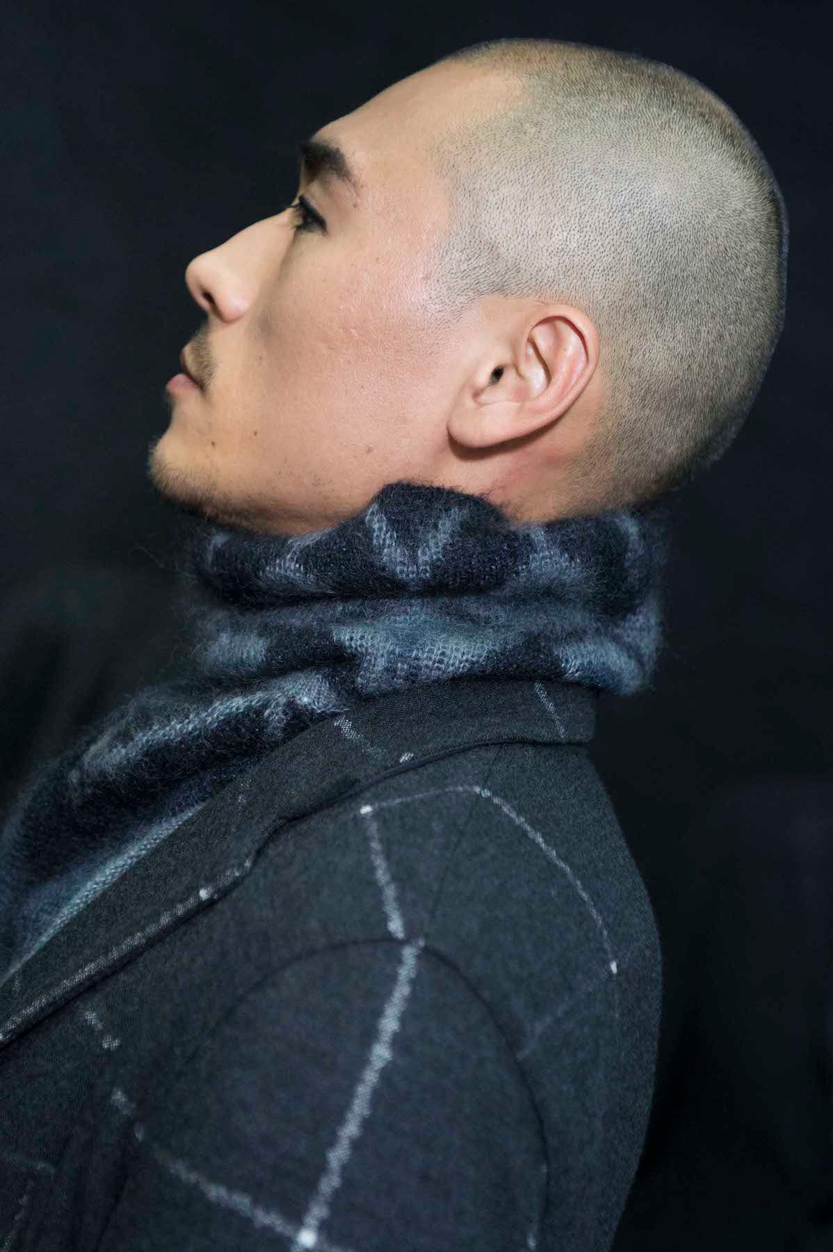 kebotakan-karena-faktor-genetik