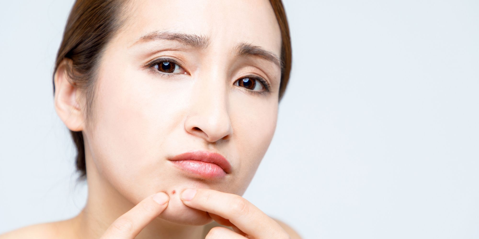 Wanita Asia sedang menyentuh jerawat di dagu