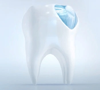 Comment éviter les caries dentaires?