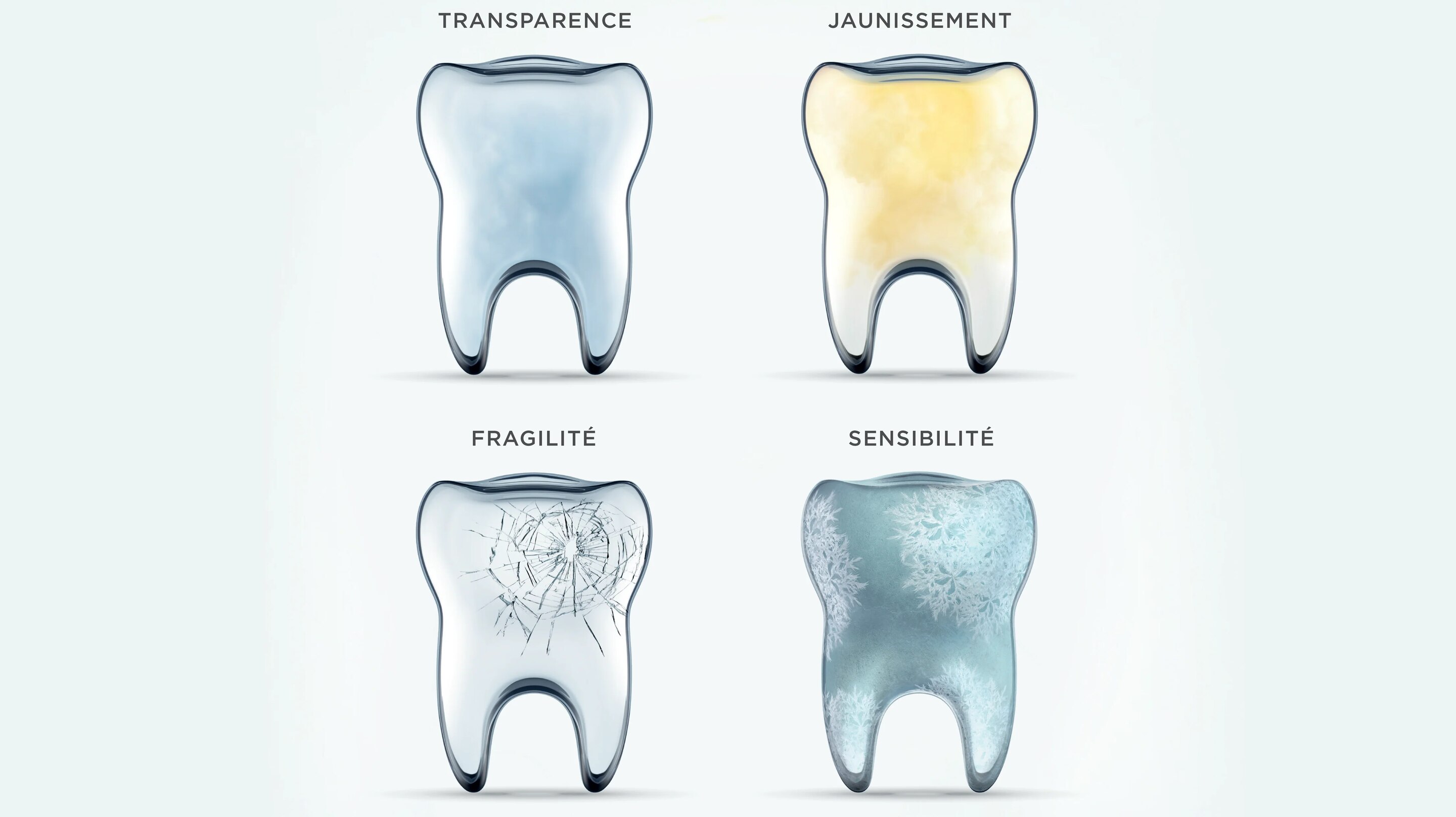graphique des signes de l'érosion de l'émail dentaire