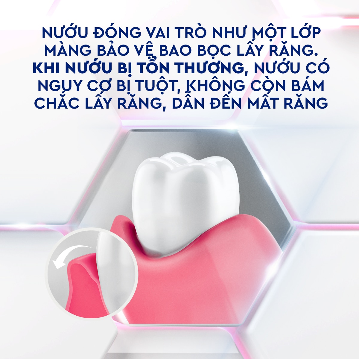 P/S Chuyên gia Chăm sóc nướu Trắng răng