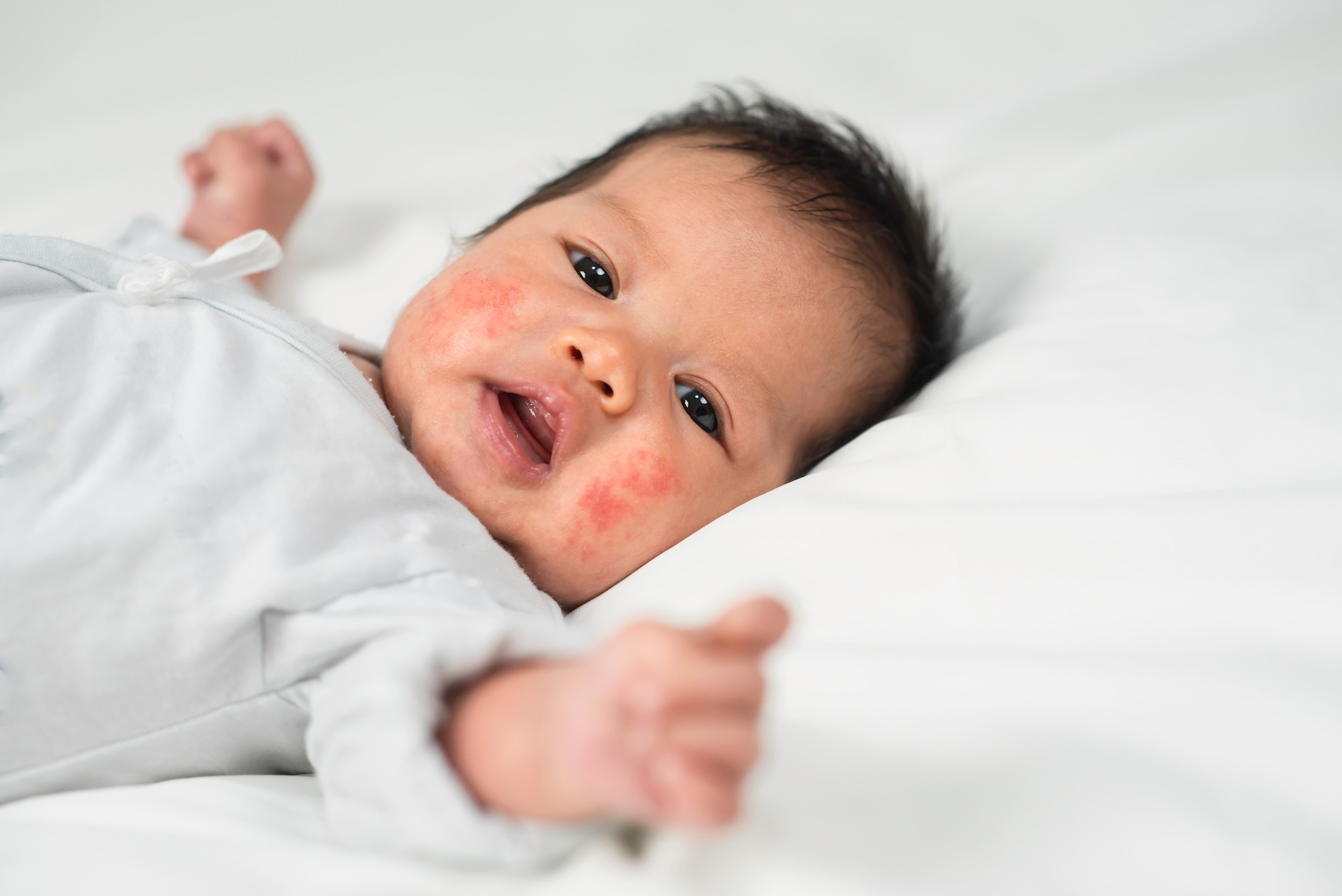Seorang bayi dengan pipi kemerahan sedang tidur terlentang