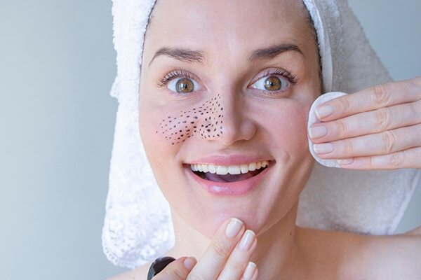 FAQs about skin gritting