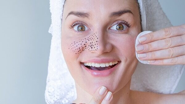 FAQs about skin gritting