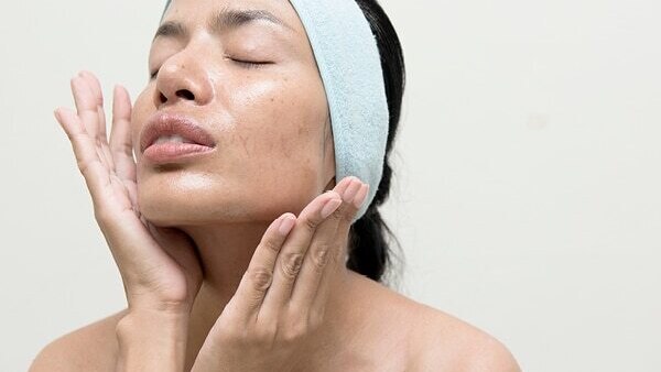 FAQs about skin gritting