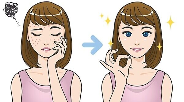 How To Remove Pimple Marks With Effective Home Remedies