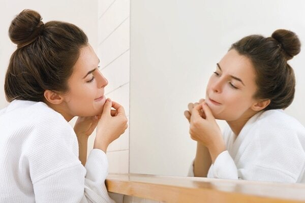 FAQs about pimple marks