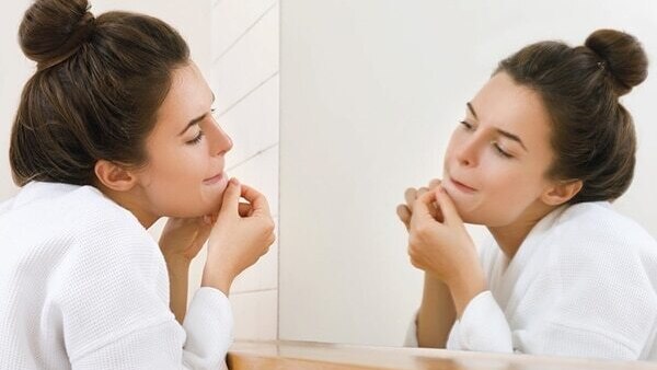 FAQs about pimple marks