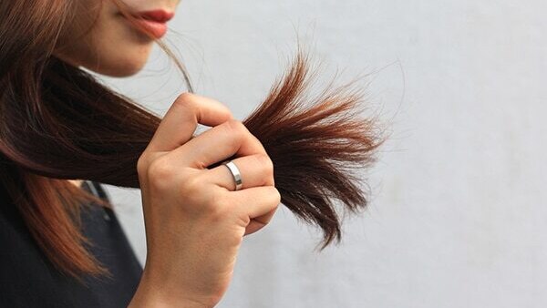 Itchy scalp