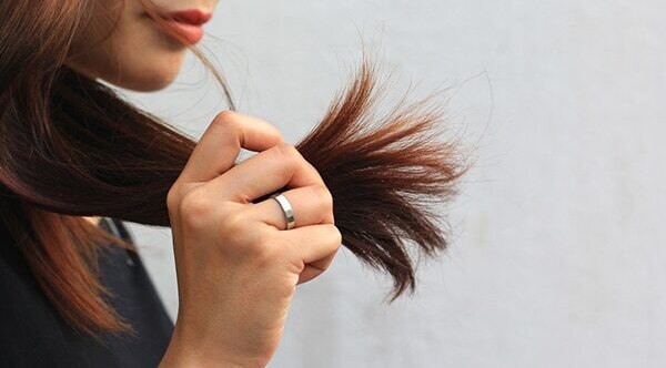 Itchy scalp
