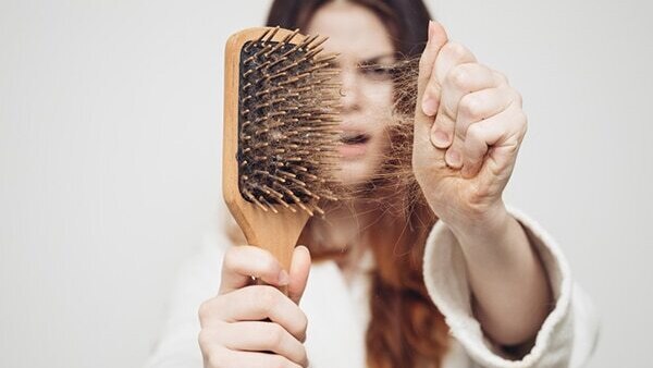 Itchy scalp