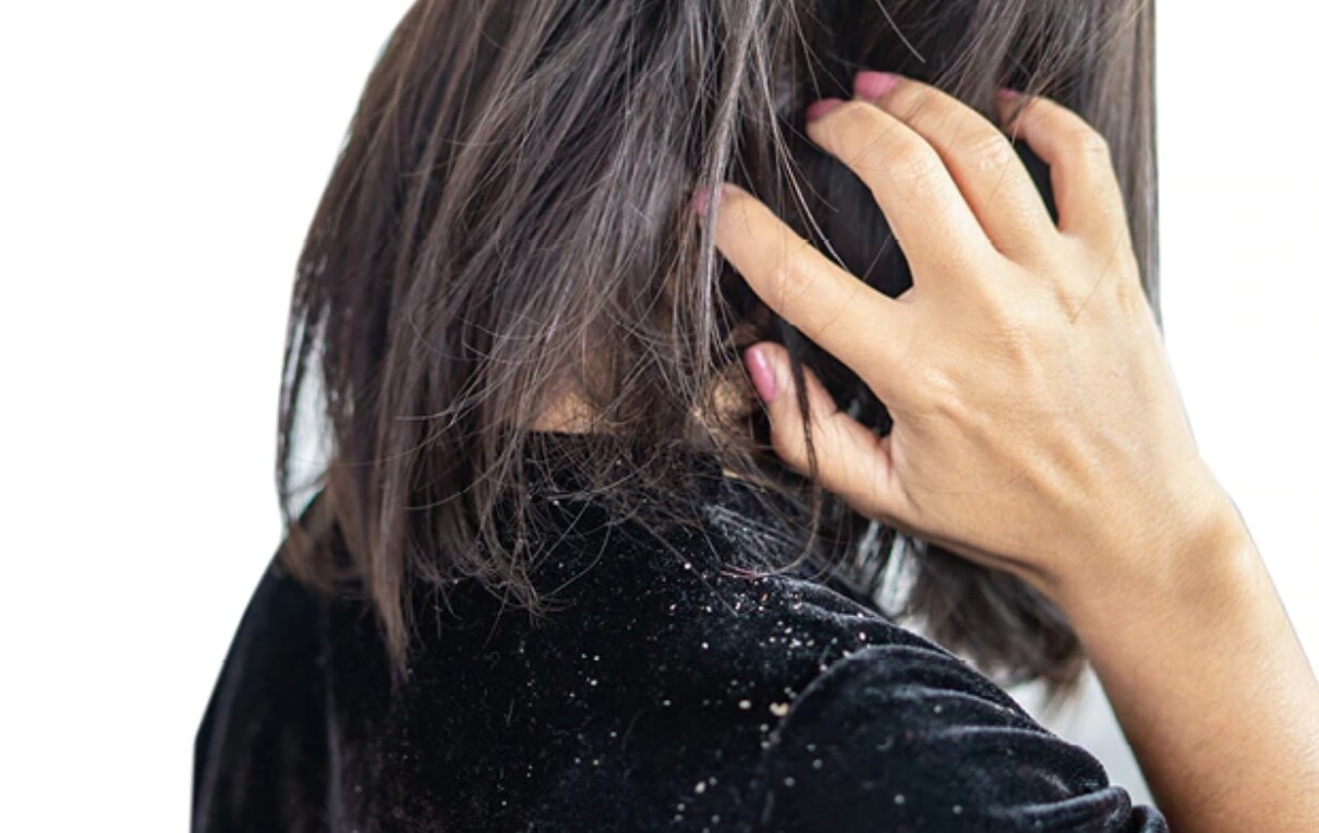 hot oil treatment for hair woman brunette