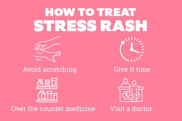 FAQs about stress rash