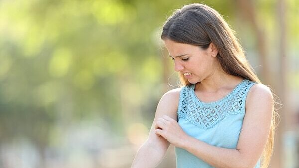 FAQs about stress rash