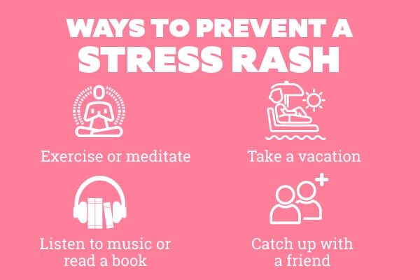 FAQs about stress rash