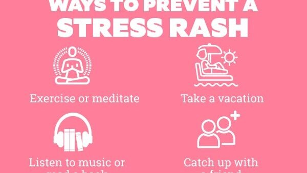 FAQs about stress rash