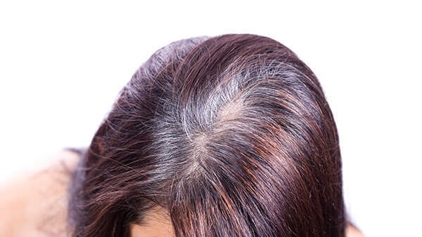Frequently asked questions about benefits of shikakai for hair