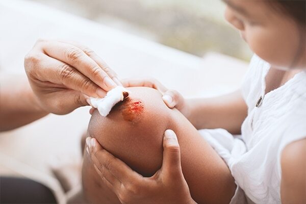FAQs about tea tree oil uses for skin and hair