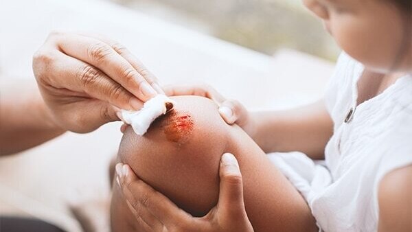FAQs about tea tree oil uses for skin and hair