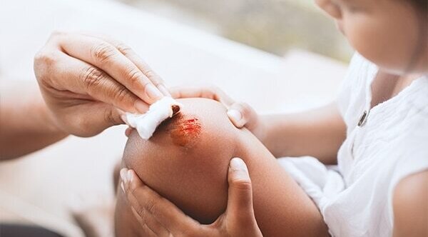 FAQs about tea tree oil uses for skin and hair