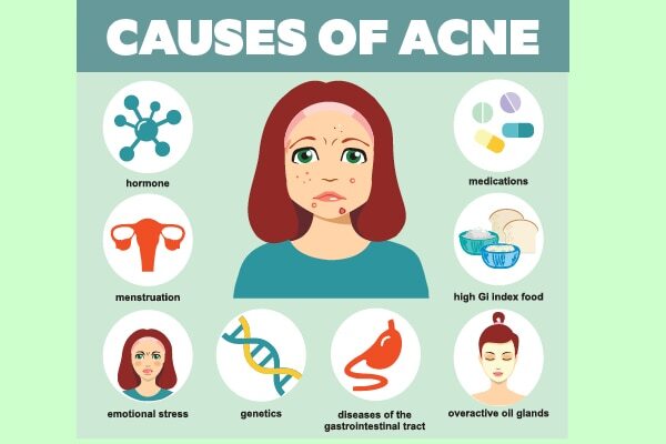 How to prevent nodular acne?