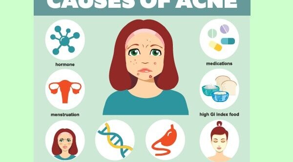 How to prevent nodular acne?