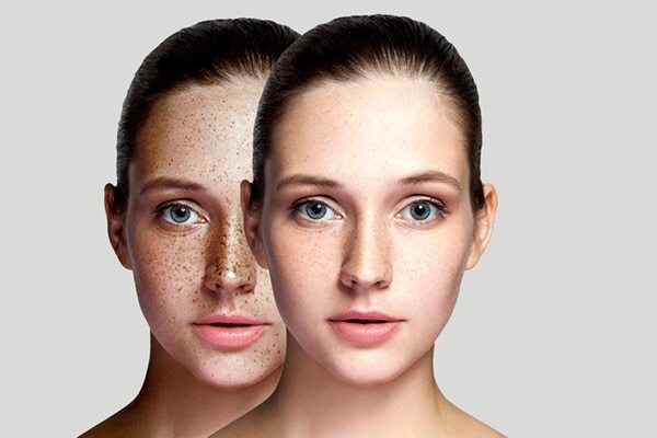 Frequently asked questions about benefits of vitamin C for the skin: