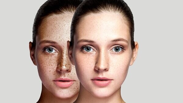 Frequently asked questions about benefits of vitamin C for the skin: