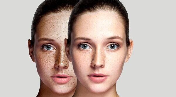 Frequently asked questions about benefits of vitamin C for the skin: