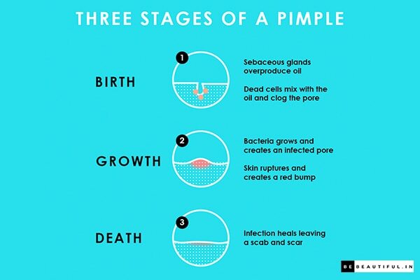 Stages :