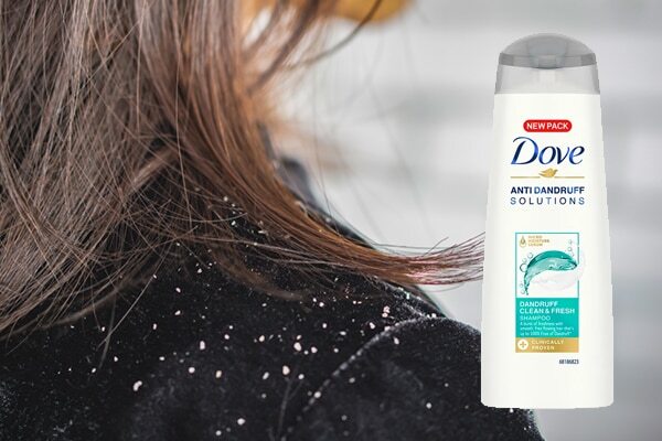 Psoriasis