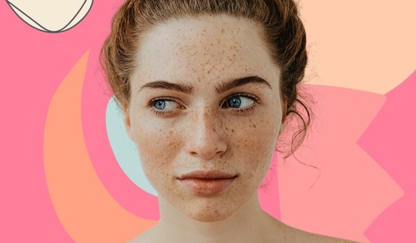 9 Expert Home Remedies For Freckles On the Face