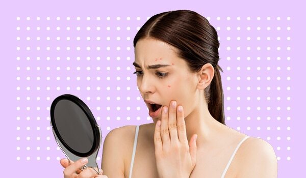 How To Soothe Angry, Irritated Skin After Going Overboard With Beauty Products