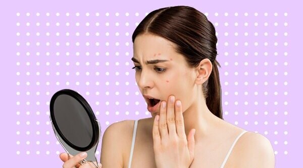 How To Soothe Angry, Irritated Skin After Going Overboard With Beauty Products