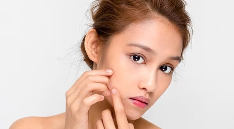 FAQs About Dragon Fruit Skincare